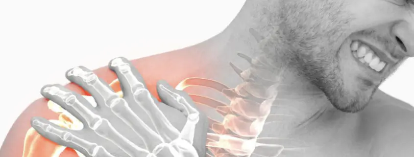 Man experiencing shoulder pain with an x-ray overlay of his shoulder and neck.
