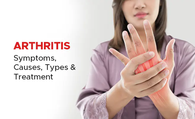 Woman holding her painful hand with overlay of hand bones, promoting arthritis information.