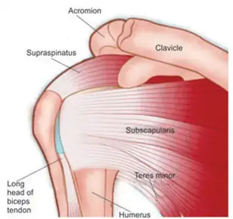 A labeled diagram of the shoulder muscles, including the supraspinatus, subscapularis, teres minor, and long head of the biceps tendon.
