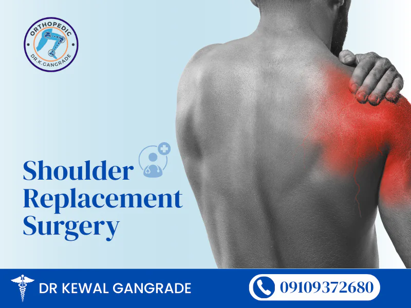 "Advertisement for shoulder replacement surgery by Dr. Kewal Gangrade